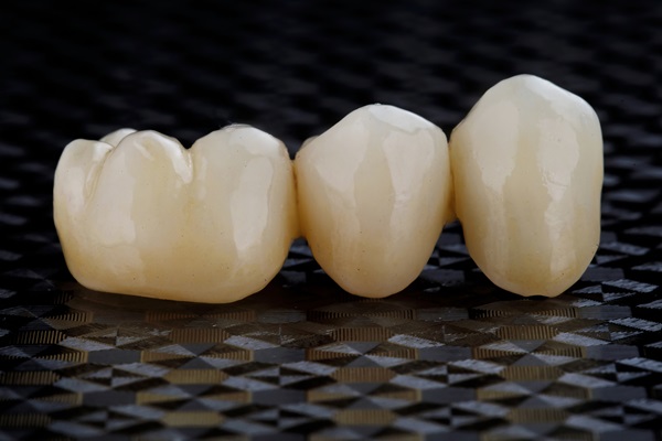 Types Of Dental Bridges: Choosing The Right Option For Your Smile