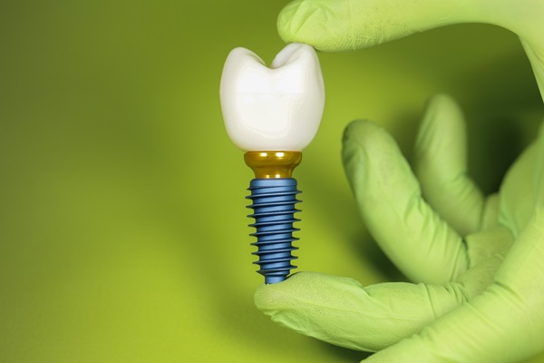 What To Do If A Dental Implant Crown Breaks